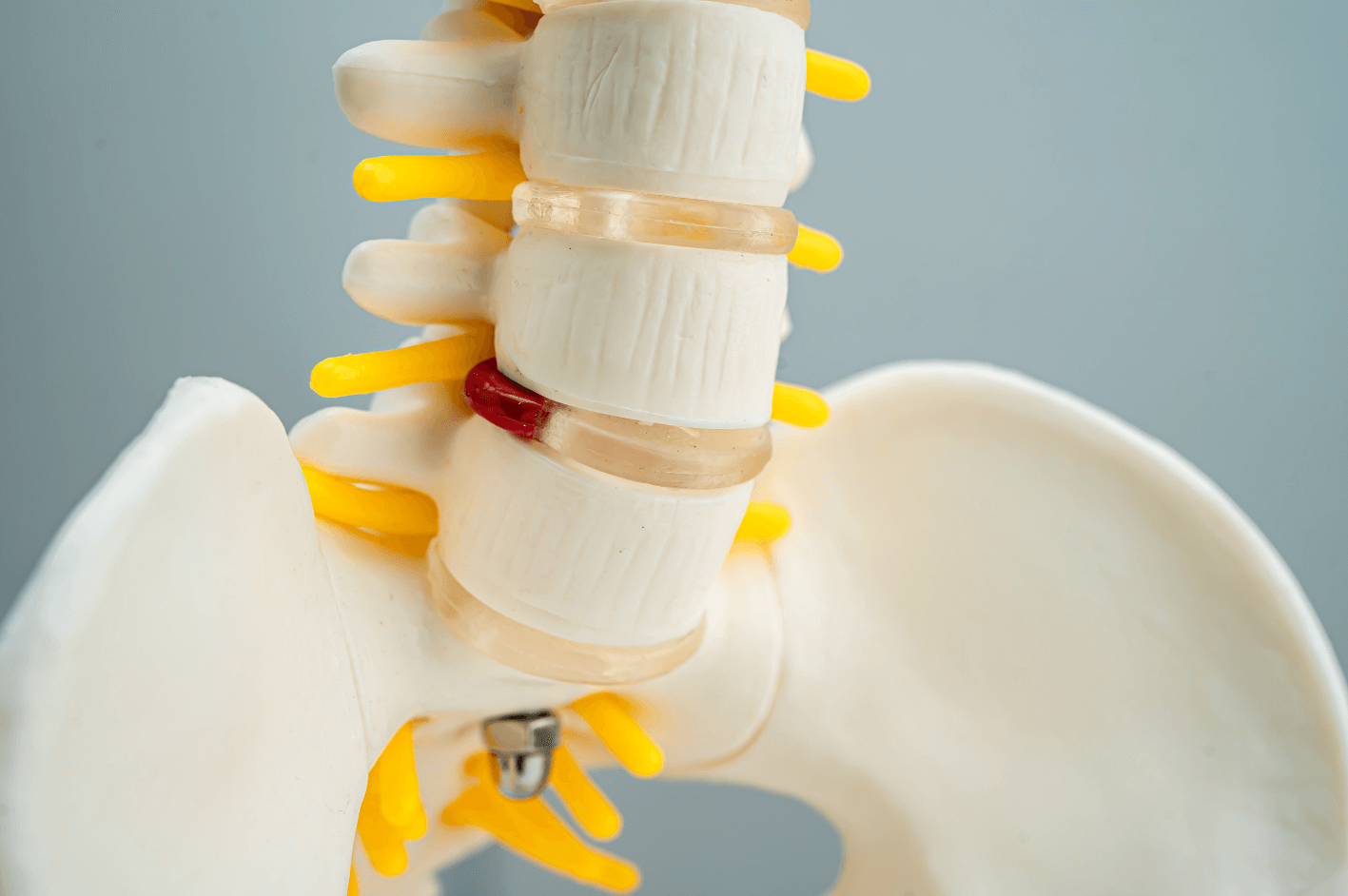 herniated disc spine health, non-surgical herniated disc options